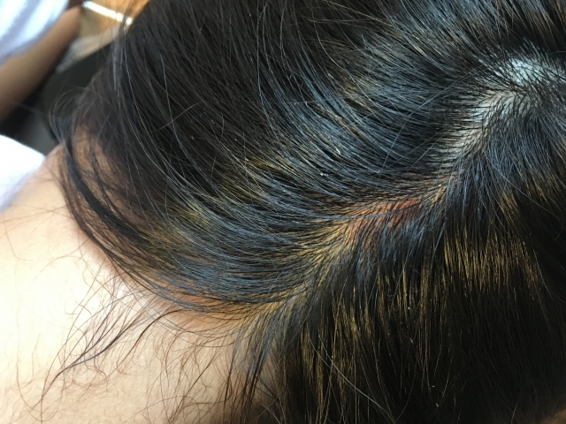 髪のパサつきの原因と対策の記事の説明用画像